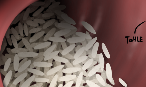 Nová položka v NBT knihovně – Rýže se zvýšeným obsahem amylosy